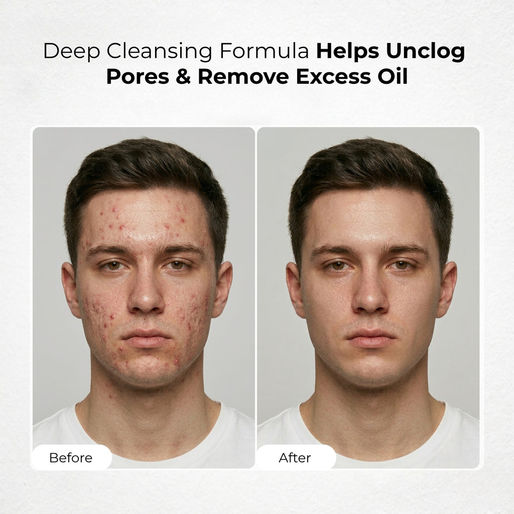 Salicylic Acid 2% Face Cleanser