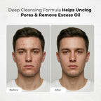 Salicylic Acid 2% Face Cleanser